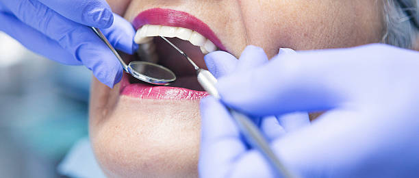 Best Emergency Broken Tooth Repair in Apple Valley, OH